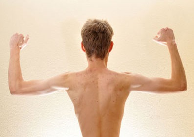 با عوارض لاغری بیش از حد آشنا شوید