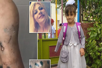 اذیت و آزار برادرزاده توسط عمه شیطان صفت