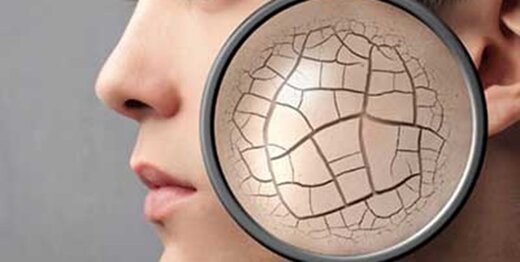 بهترین روش برای برطرف کردن خشکی پوست ناشی از مواد شوینده