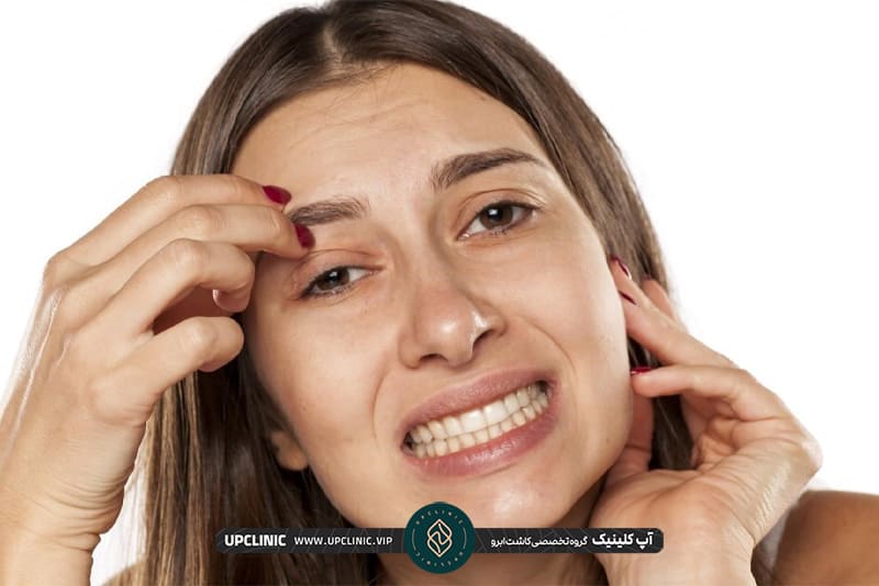 برای رفع خارش بعد از کاشت ابرو چه باید کرد؟