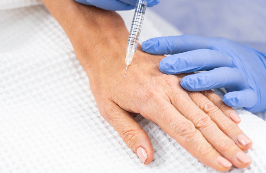 مزو و فیلر دست؛ دست‌هایی که خسته از زمان نیستند